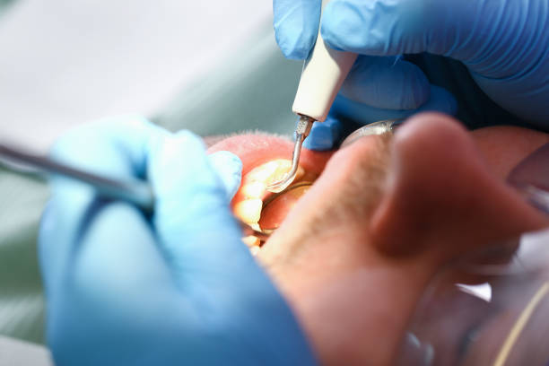 Best Emergency Dental Care for Trauma or Injury in Sleepy Hollow, WY